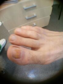 behatz lodi iltze onddoaren hasierako fasea