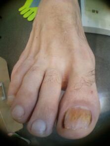 behatz lodia iltze onddoa