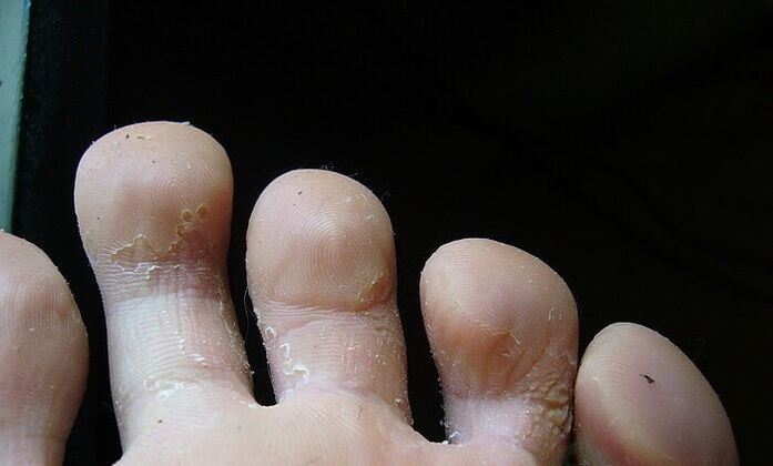 onddoaren hasierako fasea